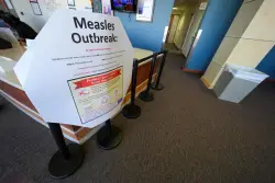These are the Colorado locations where you could have been exposed to measles